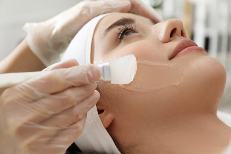 The Science Behind Chemical Peels: What You Need to Know