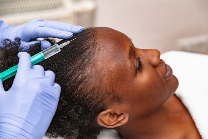 Mesotherapy for Hair