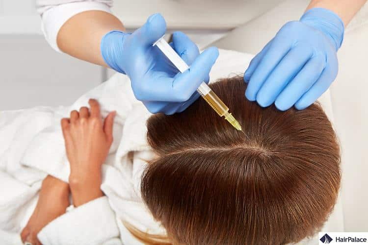 PRF Treatment for Hair